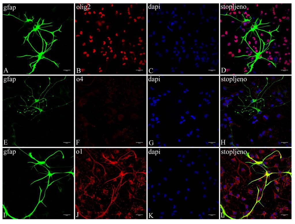 Slika 7. Imunocitokemija glija-stanica 3. dana diferencijacije in vitro.