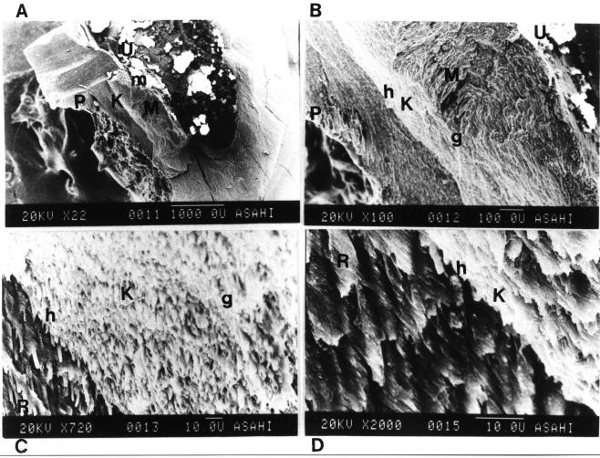 Nakon toga su stavljeni u vakum komoru i prekriveni slojem zlata debljine oko 30A za SEM analizu. little pulp tissue along root canal in the level of furcation (Fig.