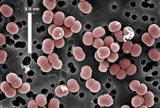 Slika 4.Pediococcus pentosaceus Izvor:http://genome.jgi.doe.gov/pedpe/pedpe.jpg 3.1.3. Rod Lactobacillus Laktobacili su Gram-pozitivne štapićaste bakterije, vrlo rasprostranjene u prirodi.