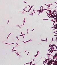 com/admin/uploads/image/bacterien/clostridium-perfringens/clostridiumperfringens_pleurav_gram-2_f-350x220.