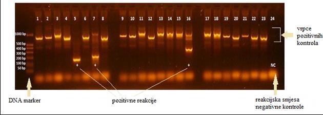 3. Ispitanici i metode Umnoženi produkti PCR-a razdvojeni su metodom agarozne gel elektroforeze.
