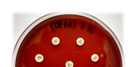 Slika 5. Antibiogram prikaz osjetljivosti testirane bakterijske kulture prema različitim antimikrobnim pripravcima, sa zonama osjetljivosti na Mueller-Hinton agaru Izvor: Semper, 2018.
