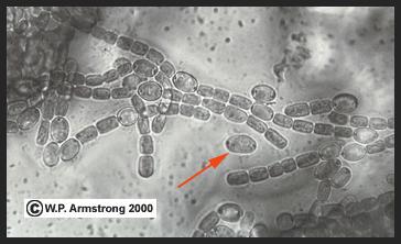 Anabena azolle