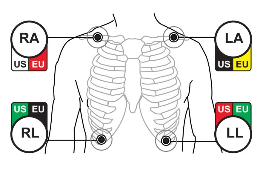 PRAĆENJE EKG-OM 9.