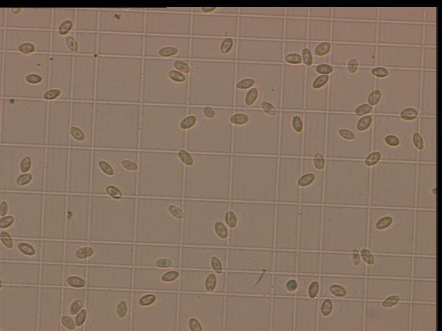 Slika 4. Brojenje eritrocita u Neubauerovoj komorici, mikroskopsko povećanje 40x. Izvor: arhiva Zavoda za patološku fiziologiju 3.4. Broj leukocita Postoji nekoliko metoda za određivanje ukupnog broja leukocita (CAMPBELL i ELLIS, 2007.