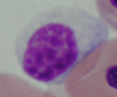 Monociti Monciti su uglavnom velike stanice, okruglog ili ovalnog oblika sa obilnom blijedo plavom citoplazmom i nepravilnom jezgrom.