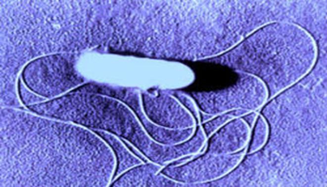 Slika 2.2.2. Lofotrihne flagele na bakterijskoj stanici L. monocytogenes Izvor: https://medium.com/@microbeaday/listeria-monocytogenes-646c323d0039) 2.3. Metode određivanja bakterije L.