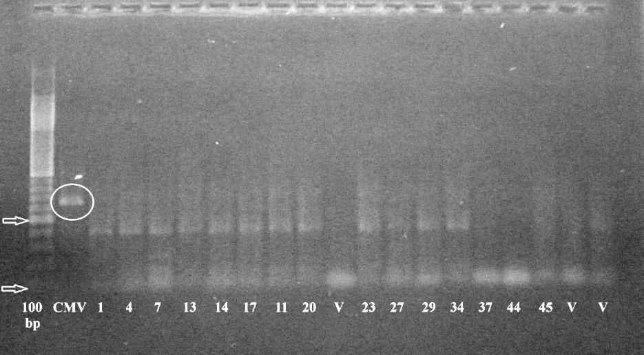 4.4. ELEKTROFORETSKA ANALIZA PRODUKATA RT-PCR REAKCIJE Elektroforetske analize produkata RT-PCR reakcije nisu potvrdile prisutnost traţenih virusa u odabranim uzorcima mahunarki i sezama (Sl. 7.).