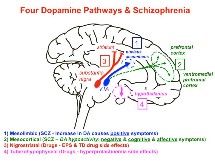 pojačavanje dopaminergične aktivnosti lijekovima kao što su levodopa, amfetamin, bromokriptin i apomorfin pogoršava psihozu ili u nekih bolesnika izazove de novo psihozu postmortalnom analizom je