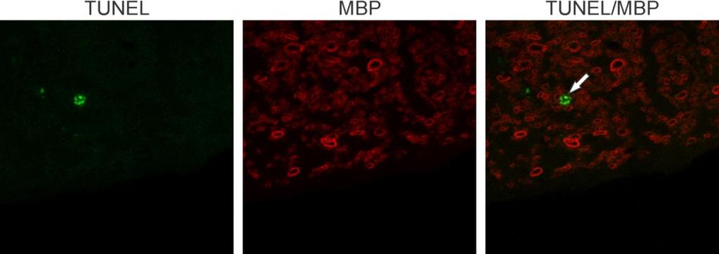 Kako bismo identifikovali apoptotične ćelije prisutne u beloj masi KM bolesnih životinja, vršeno je dvostruko TUNEL/MBP bojenje.