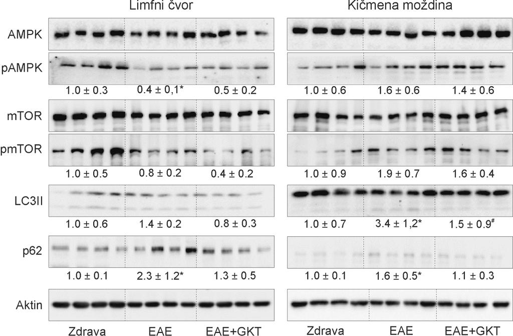 Slika 16. Efekat GKT na autofagiju u EAE. Drenirajući limfni čvorovi (7. d-p.i.) (n=4) i lumbosakralni delovi KM (14. d.p.i.) (n=4) su prikupljeni od kontrolne EAE grupe i grupe koja je tretirana sa GKT (10 mg/kg) (EAE+GKT).