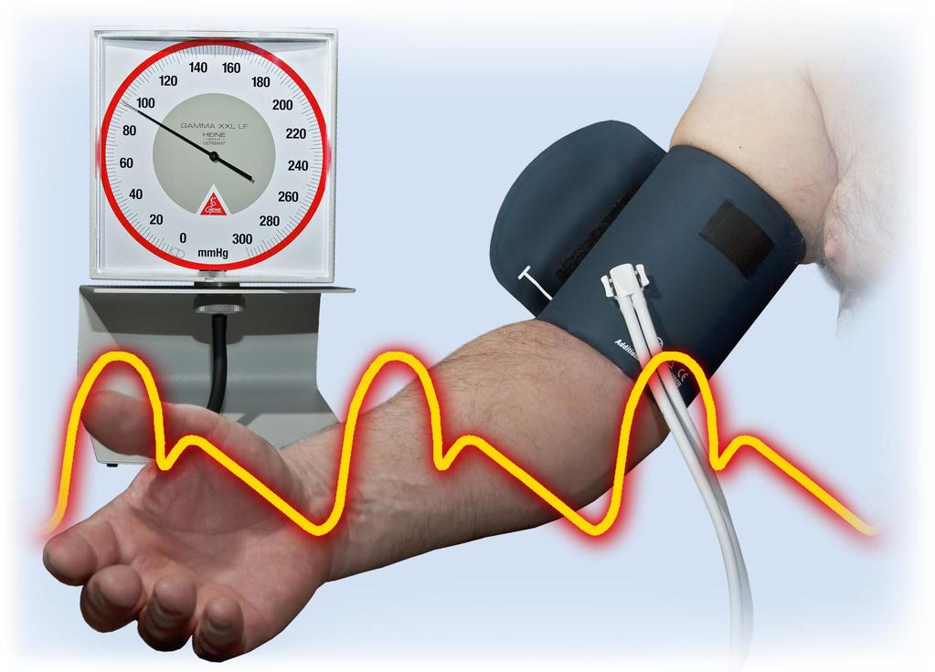 mehanizam hipertenzije bolesti