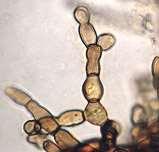 micelijuma. U ciklusu razvića imaju samo micelijum i sklerociju. Obuhvata dva roda: Sclerotia i Rhizocontia.