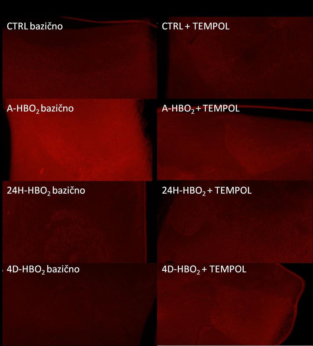 Fotografije tkiva aorte bojanog DHE bojom snimljene Olympus DP70 kamerom na fluorescentnom mikroskopu pod najmanjim povećanjem uz filter set 15 prije i nakon primjene TEMPOL-a pokazuju najveći