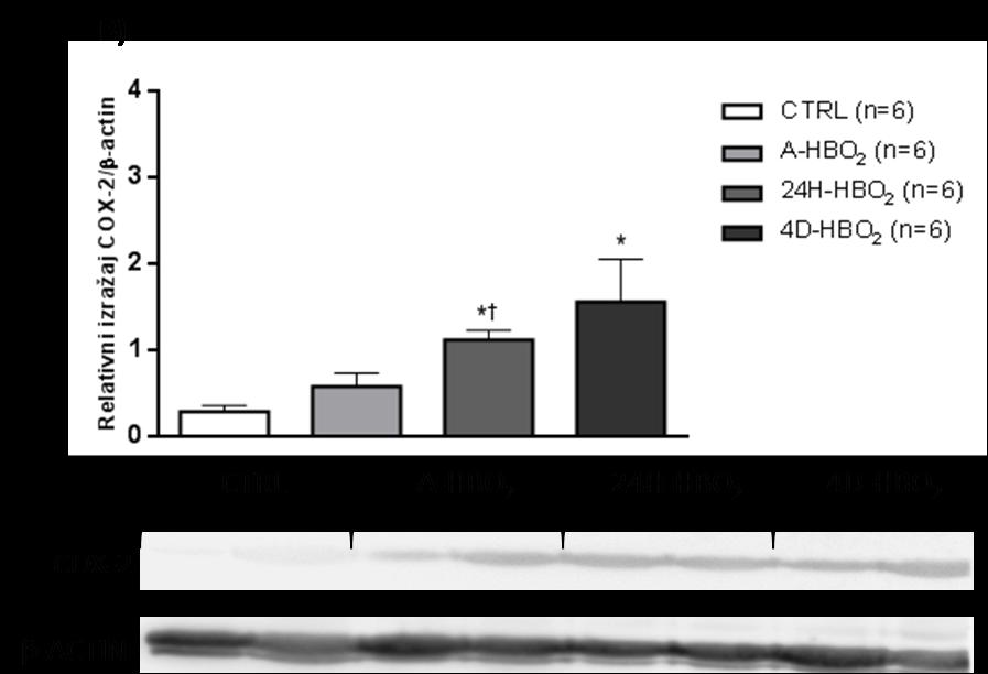 5.6. Relativni izražaj proteina u tkivu aorte Relativni izražaj COX-2 i CYP2c11 proteina značajno je