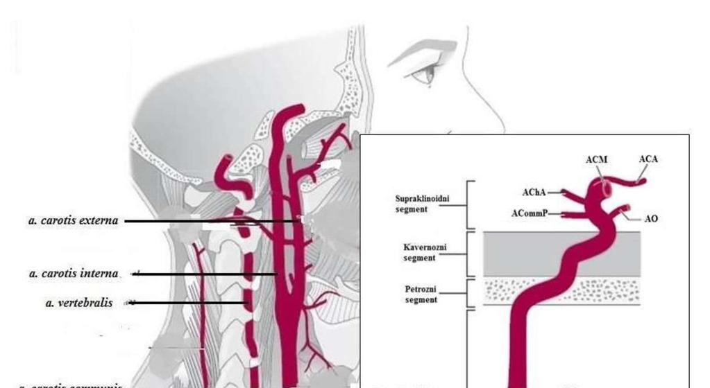 Slika 12. A Ekstrakranijski dio moždane cirkulacije. B Unutarnja karotidna arterija sa svojim terminalnim granama. ACM a. cerebri media, ACA a. cerebri anterior, AChA a. choroidea anterior, ACoP a.