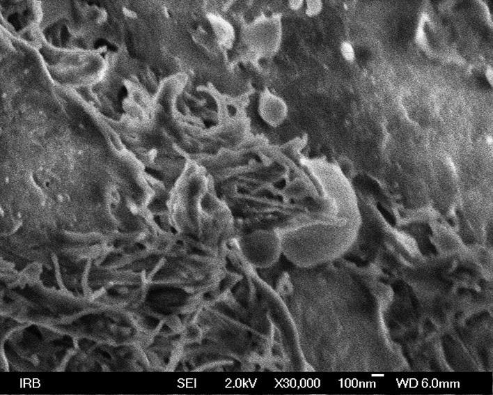 Slika 5.7. Razoreni epitel sluznice maksilarnog sinusa u bolesnika s ACP-om s bakterijama od kojih su neke čvrsto uklopljene, početak stvaranja biofilma (SEM x 10 000, x 30