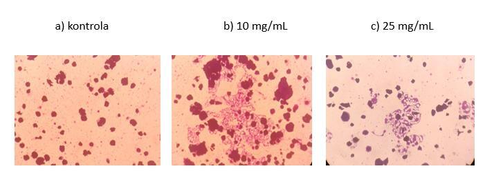 4.2. Učinak subkritičnog vodenog ekstrakta đumbira na morfološke promjene u MCF-7 stanicama određene bojanjem kristal-ljubičastim Tijekom određivanja utjecaja dodatka subkritičnih vodenih ekstrakata