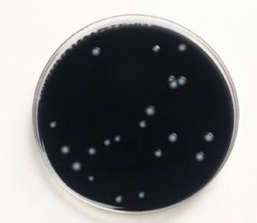 4. Rezultati Slika 4.5. GVPC agar bez kolonija Legionella spp.