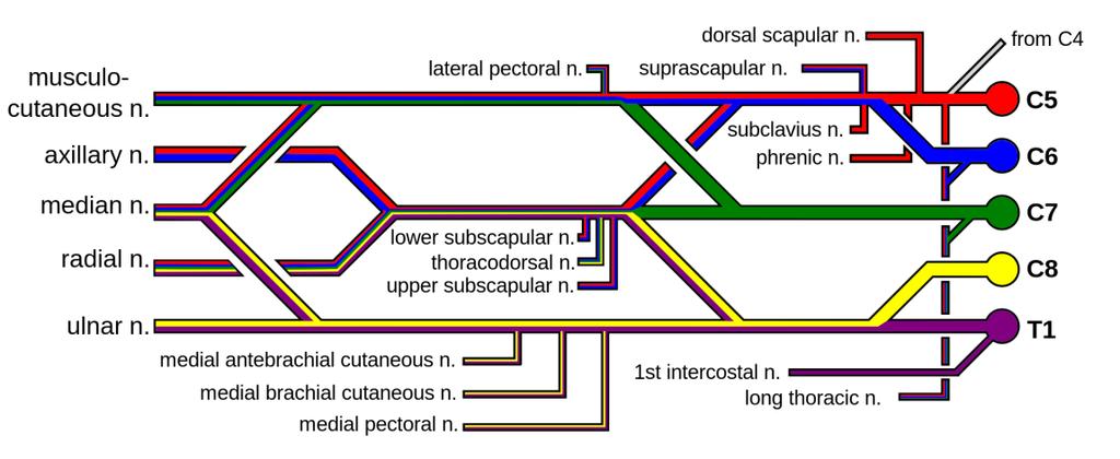 Slika 1. Plexus brachialis (Preuzeto s: Wikimedia. Godina 2009. Strother M) 1.2 OŠTEĆENJE PERIFERNIH ŽIVACA Oštećenje pleksusa brahijalisa spada u oštećenja perifernih živaca.