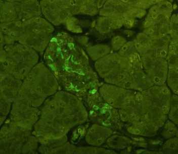 Slika 11. Histološki presjek tkiva gušterače dijabetičnog miša tretiranog koštanom srži. Unutar Langerhansovog otočića se uočava veliki broj stanica pozitivnih na ekspresiju Nanog-a.