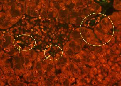 Slika 15. Histološki prerez tkiva gušterače dijabetičnog miša tretiranog koštanom srži kontrastiran propidijevim jodidom.