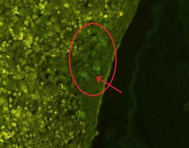 Slika 19. Histološki prerez slezene dijabetičnog miša tretiranog koštanom srži. Unutar tkiva se uočavaju stanice s citoplazmom pozitivnom na Pdx-1.