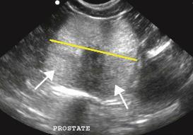prostatica, direktne grane a. pudendalis, koja se opet grana u 3 grane kroz prostatu (kranijalnu, srednju i kaudalnu). Nadalje, podijeljena je u 3 vaskularne zone: kapsularnu, parehimsku i uretralnu.