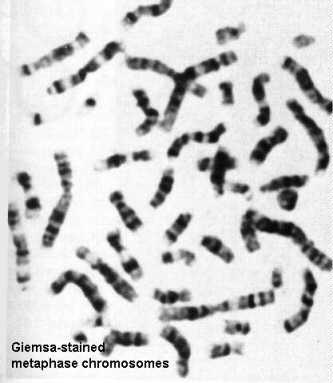 Metafazni hromozomi obojani Giemsa bojom
