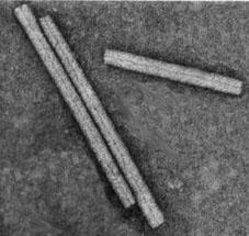 1) Samostalno pakiranje virusne DNK/RNK u kapsidu: TMV Virus mozaične bolesti duvana (Tobacco Mosaic Virus TMV)