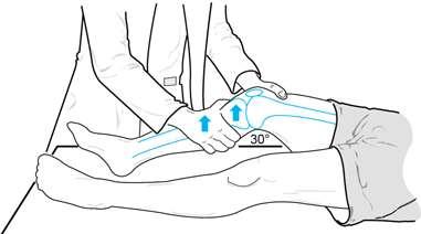 3.6.1 Ларчманов тест (Larchman test) Тест се изводи када пацијент лежи са коленом савијеним око 20-25 степени, а стопало је