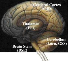Affinity Prioni zahvacaju razne regije mozga Spuzvasta degeneracija