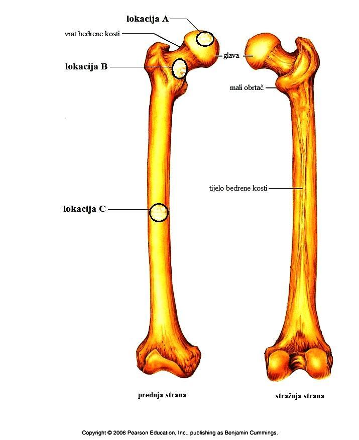 Slika 4. Bedrena kost s oznakama 3 pozicije uzimanja uzoraka. Prilagođena slika preuzeta je od Pearson Education.