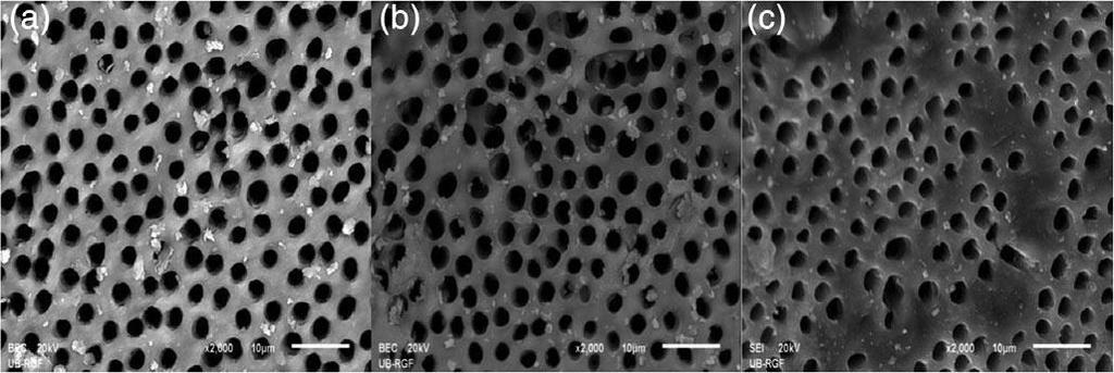 5 NOGO-ŢIVANOVIC ET 5 NOGO-ŢIVANOVIC ET FIGURE 2 Representative SEM micrographs of root canal wall dentin after final irrigation with QMix (magnification 2,000 ): (a) apical third, (b) middle third,