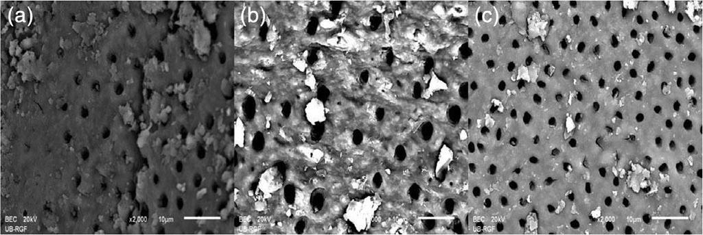 third FIGURE 4 Representative SEM micrographs of root canal wall dentin after final irrigation with distilled water (control group) (magnification 2,000 ): (a) apical third, (b) middle third, and (c)