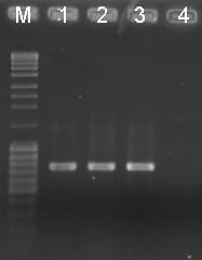 751 bp Slika 24. Detekcija odabranih izolata AMV iz paradajza primenom One-step RT-PCR korišćenjem CP AMV1/CP AMV2 prajmera.