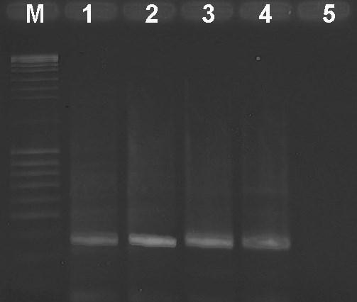 334-390 bp Slika 27. Detekcija odabranih izolata CMV satrna iz paradajza primenom One-step RT-PCR korišćenjem CMVsat-fwd/CMVsat-rev prajmera.