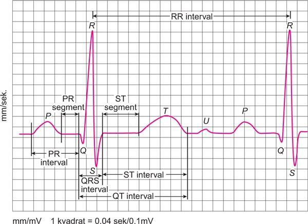 2. Struktura EKG signala 2.1. EKG signal EKG (elektrokardiogram) je signal koji prikazuje ovisnost električne aktivnosti srca o vremenu. Taj koncept otkrio je 1901.g. Willem Einthoven kako bi 1924.g. za svoje otkriće bio nagra den Nobelovom nagradom za medicinu.