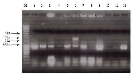 Rezultati dostupni. Pet introna u genu Rad51D iz vrste Suberites domuncula nalazi se u fazi nula, dva introna se nalaze u fazi jedan, jedan intron je u fazi dva.