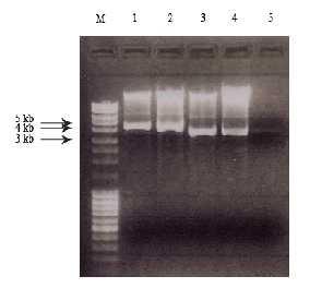 Rezultati Odabranih 12 klonova provjerili smo na dva načina: pomoću kolonijskog PCR-a, a zatim i izolacijom plazmidne DNA i određivanjem njene sekvence. Rezultati su provjereni u agaroznom gelu.