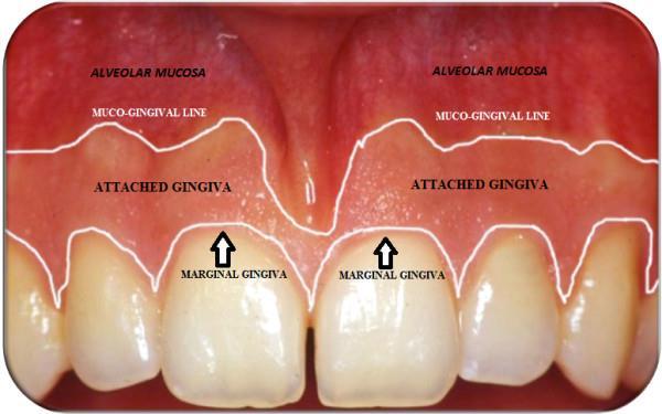 1. UVOD Usna šupljina (cavum oris) kao dio probavnog sistema je podijeljena na predvorje (vestibulum) i usna šupljina u pravom smislu (cavum oris
