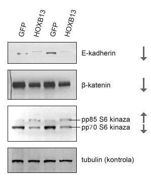 3.1.2 Negativni utjecaji gena HOXB13 Western blot analiza proteinskih lizata T1-GFP i T1-HOXB13 stanica otkrila je da ektotopsko izražavanje gena HOXB13 utječe na smanjenje ukupne količine