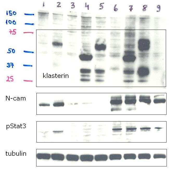 3.2.3 Western blot analiza T1-klasterin tumora Proteinski ekstrakti izoliranih tumora pružili su dokaz da je izražavanje klasterina u novim T1-klasterin staničnim linijama stabilno i u uvjetima in