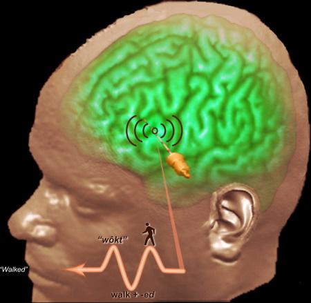 Traumatsko sjećanje - PET Pozitronska tomografija (PET skener) - pri aktivaciji sjećanja na traumatičan događaj: aktivira se amigdala i okolno područje (središte za strah emocionalnog mozga) aktivira