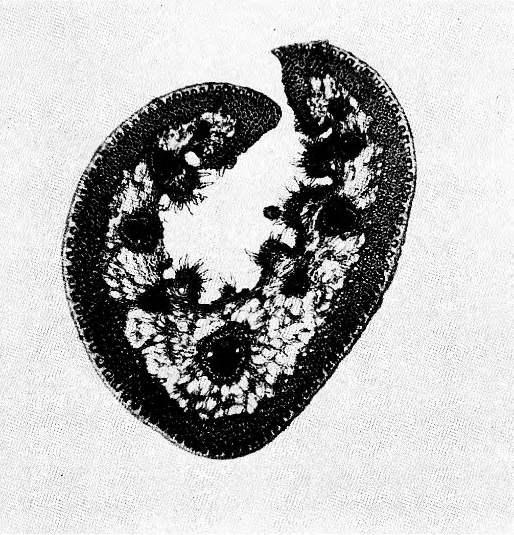 Microphotograph of the leaf cross section of Festuca