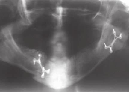 Snimak načinjen multislajsnim CT-om po prijemu pacijenta na Kliniku Figure 1a, 1b, 1c.