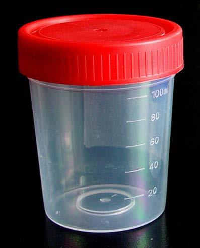 ODREĐIVANJE ANALITA U URINU plastična posuda za urin (osigurava laboratorij) min 30 ml urina Podaci Datum i vrijeme uzimanja urina Podaci o pušenju Izloženost bojama, lakovima i sl.