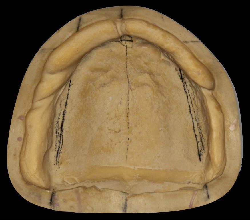 3.1. Označavanje radnog modela Prije postave zubi potrebno je označiti pojedine anatomske strukture na radnom modelu (Slika 9. i 10.).