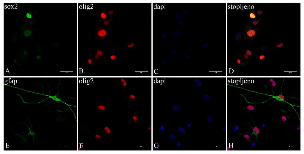 Slika 5. Imunocitokemija glija-stanica 1. dana diferencijacije in vitro.
