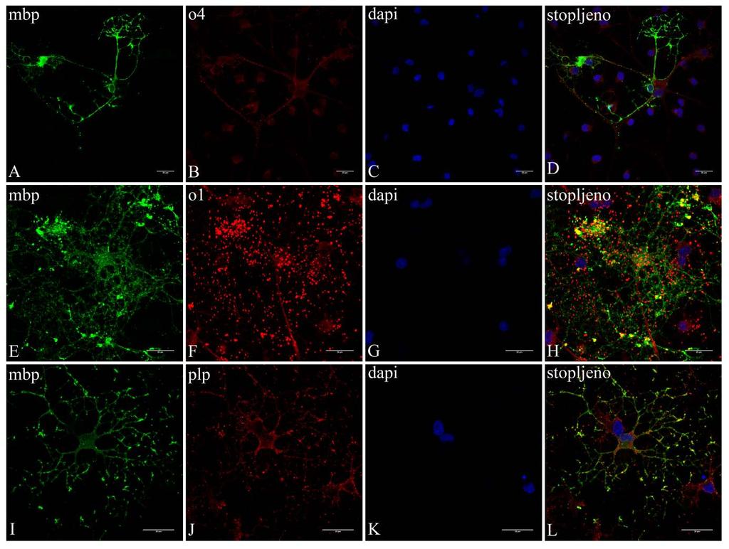 Slika 9. Imunocitokemija glija-stanica 7. dana diferencijacije in vitro.